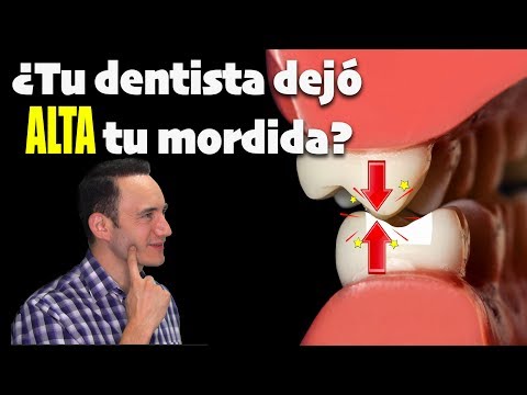 Video: ¿Deberían tocarse los dientes al masticar?