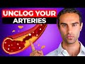 1 best supplement to clean plaque from your arteries