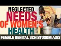 Special event tackling female genital schistosomiasis fgs