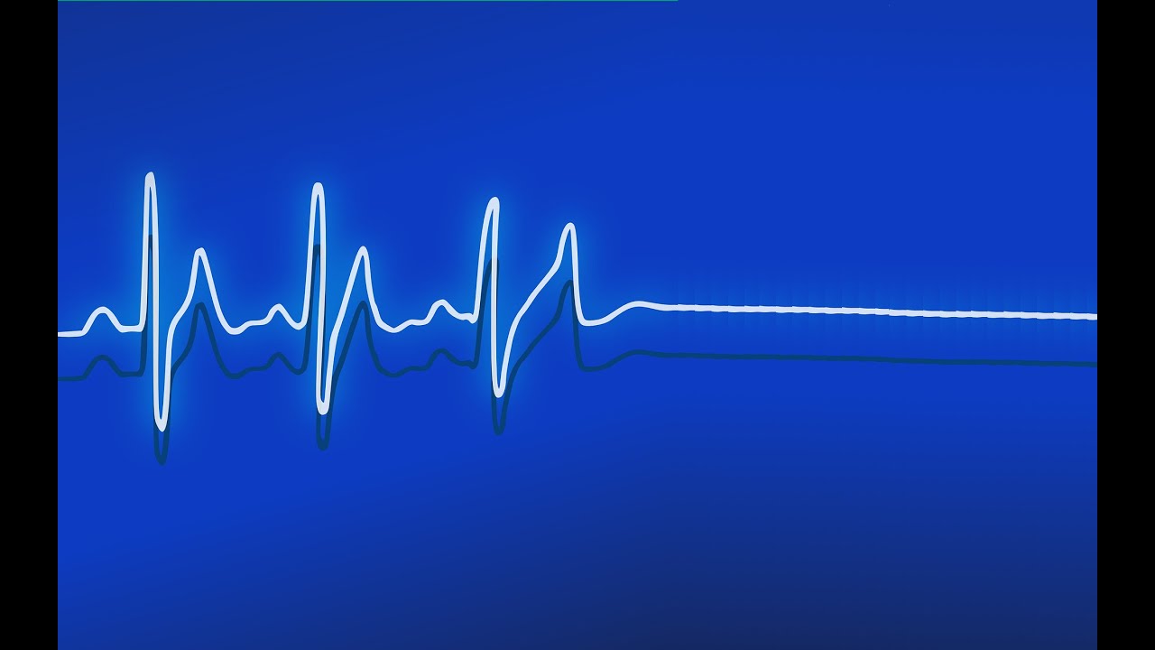 Egy hatalmas EMP a tranzisztoros korszak rossz napját jelentené. Faraday kalitka