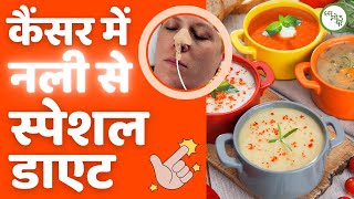 Feeding Tube for Cancer Patients I Indian Diet for Cancer screenshot 4