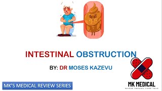 Intestinal Obstruction || IO