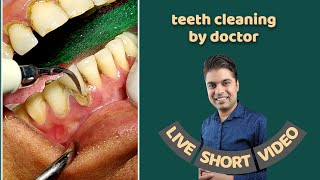 teeth cleaning by doctor । dentist preparing for teeth cleaning or removing tartar by machine screenshot 2