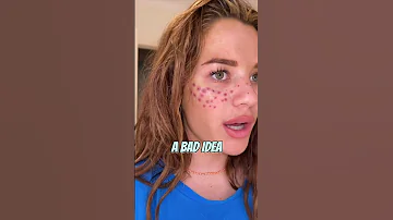 Part 2 TikToker tattoos freckles on her face. this is her now #shorts #tiktok