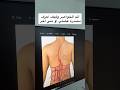 ألم الخواصر وكيف اعرف إذا مصدره عضلي او سبب آخر اكسبلور ترند علاج طبيعي التهاب تيك توك طب