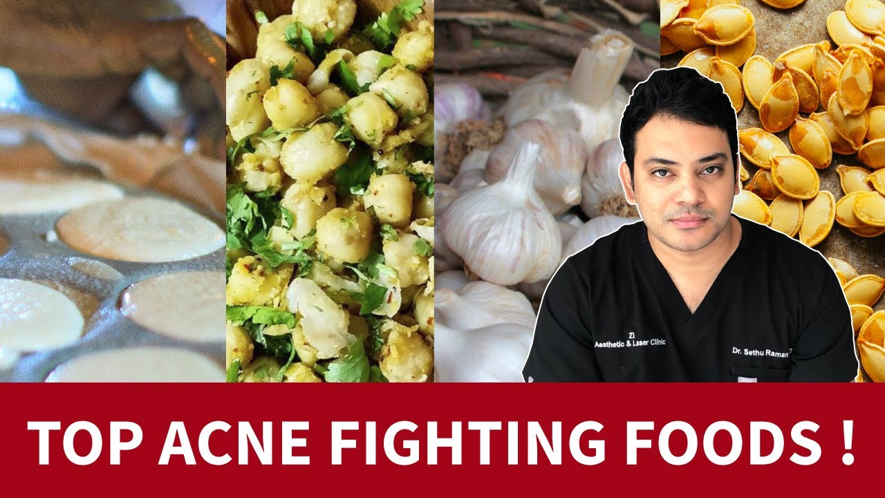 Pimples (Acne) வராமலிருக்க இதை சாப்பிடுங்க !!! Acne Diet Tips | Dr. Sethu