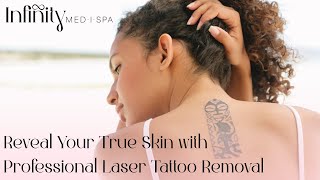 TATTOO REMOVAL EXPLAINED Infinity Medi Spa Greystone