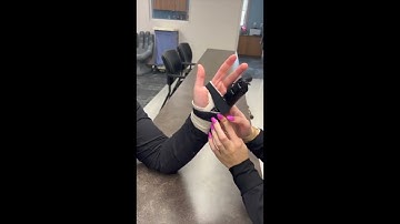 How to Fabricate a Hand-Based Ulnar Gutter Orthosis