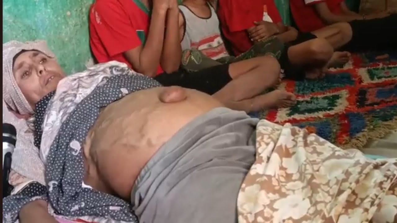 ”جمعة” أم لأربعة أطفال بالناظور تعاني من مرض خطير تناشد المحسنين من أجل تلقي العلاج