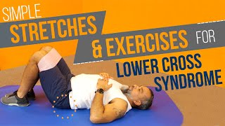 Exercises and Stretches for Lower Cross Syndrome