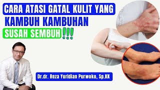 Cara Atasi Gatal Kulit yang Kambuh Kambuhan susah sembuh!!