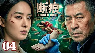 【2026待播剧抢先看】《断痕》EP04 | 污水池底惊现18岁女尸，双脚被活割！他痴恋心理医生💔却亲手揭开真相——这个池子，究竟埋了多少人？ screenshot 4