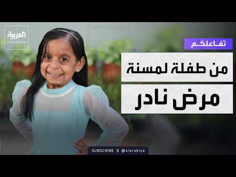 Tafa3olkom | Rare disease turns an Indian child into an elderly person