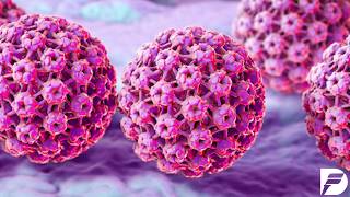 Metastatic HPV-linked head and neck cancer study
