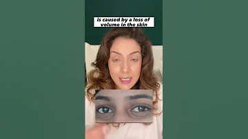 Listen If You Have Under Eye Hollowness Shortsvideo Skincare Skincaretips 