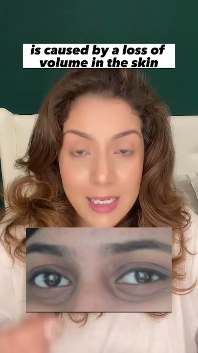 Listen if you have under eye hollowness #shortsvideo #skincare #skincaretips
