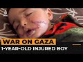 Injured Gaza 1-year-old suffers 200 facial stitches and hand amputation | Al Jazeera Newsfeed