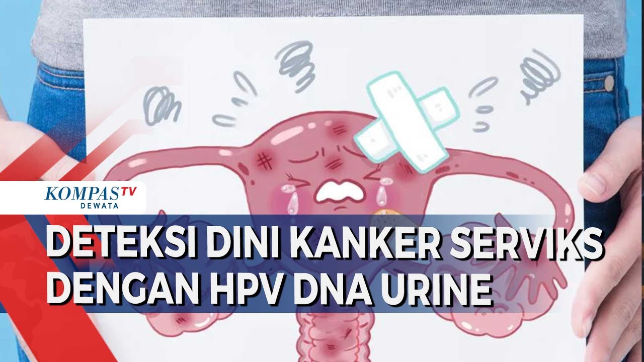 Deteksi Dini Kanker Serviks Dengan HPV DNA URINE - YouTube