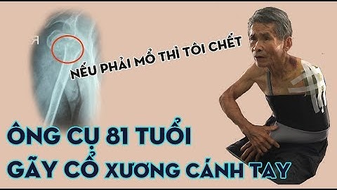 Gãy xương cánh tay cổ phẫu thuật là gì năm 2024