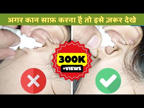 वीडियो: इयरड्रॉप का मतलब क्या होता है?