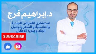 حب الشباب اثاره وعلاجه