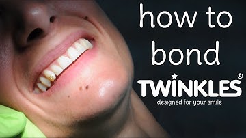 Twinkles Dental Jewelry - Bonding Instructions