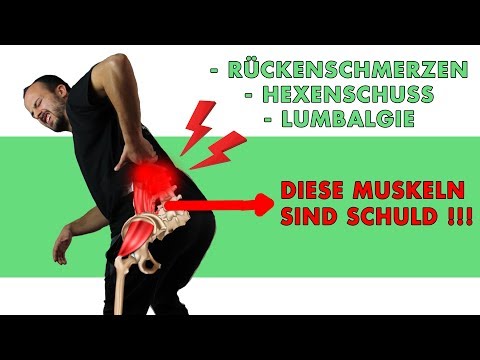 Video: Was Verursacht Meine Schmerzen Im Unteren Rücken Und In Der Hüfte?