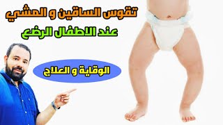احمي طفلك الرضيع من تقوس الساقين و ساعديه علي المشي الصحيح في 7 خطوات سهلة و بسيطة و سريعة