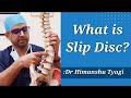 What is slip disc disc prolapse herniation lumbar pivd disc protrusionspine disc degeneration