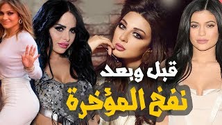 مؤخرة النجمات قبل وبعد النفخ = صور لم تروها من قبل