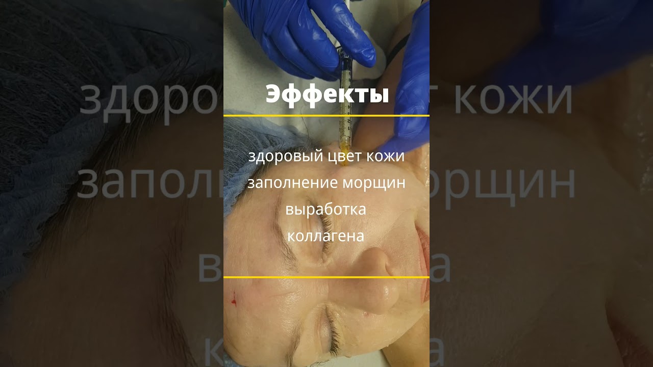 Плазмотерапия Эндорет - методика омоложения плазмой крови