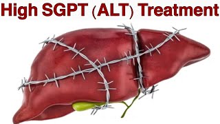 High SGPT (ALT) Treatment | 9 Ways to lower the levels of ALT quickly