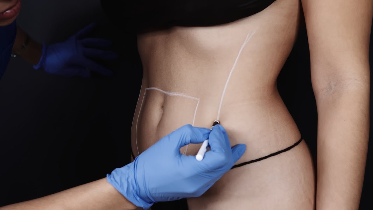 Dallas Body Contouring Center | Belleza Colombiana Spa | Non-Invasive Body Contouring Treatment