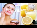 Most Effective Sun Tan Removal Home Remedy for Hands/Body REMOVE FACE TAN IN 2 MINUTES #beautytips