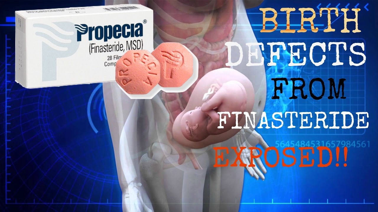 does finasteride prevent pregnancy