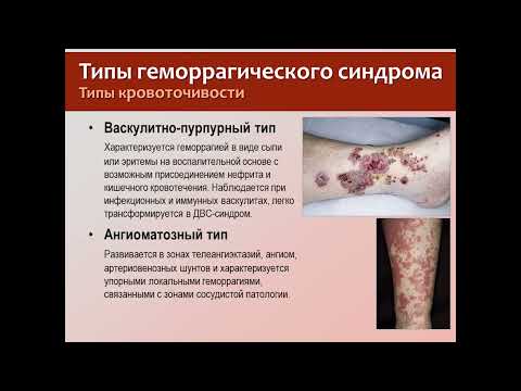 Геморрагические диатезы