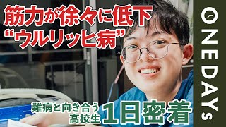 【患者会の代表】ウルリッヒ病の高校生に1日密着してみた