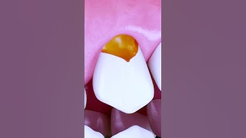 The most awful feeling! Popcorn kernel is stuck in my teeth! 🤬🍿