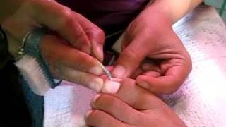 pedicure part 2