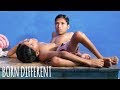 World Famous Conjoined Twins Turn 18 | BORN DIFFERENT