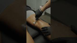 Knee treatment  #painrelief