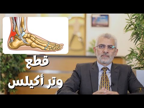 فيديو: أي أخيل تمزق؟