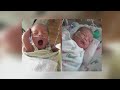 Colorado Twins Born To Mother With Coronavirus Remain In NICU