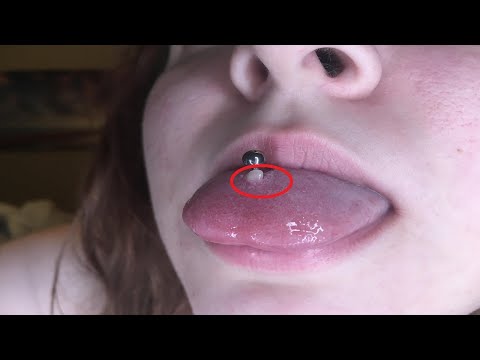 Wideo: Jak pozbyć się martwej skóry na przekłuciu języka?