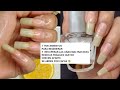 7 TRATAMIENTOS PARA REGENERAR Y RECUPERAR LAS UÑAS MALTRATADAS RESECAS, FRÁGILES QUE NO CRECEN 😱