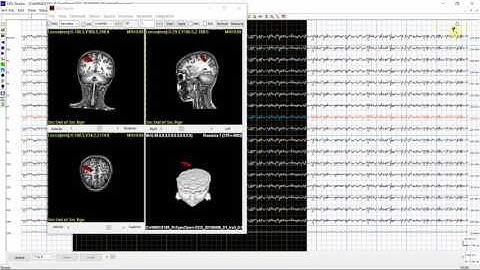 Source View and Analysis