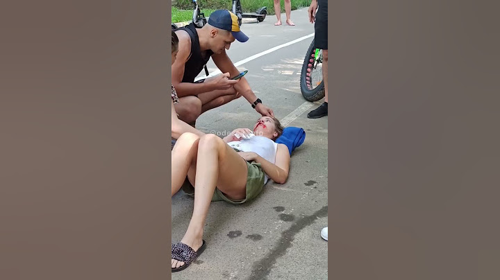 В Одессе девушка упала с электросамоката и разбила лицо