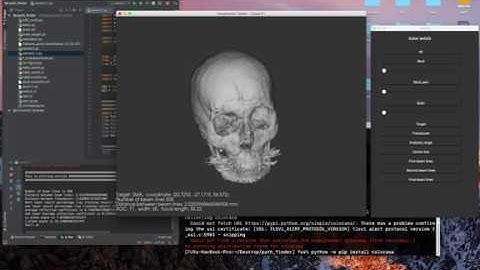 #1 Find the optimal position of the transducer to stimulate the brain