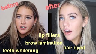 ultimate transformation (lip filler, brows, teeth etc)