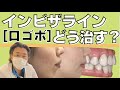 インビザライン あるある　患者様編　出っ歯(口ゴボ)の治療1